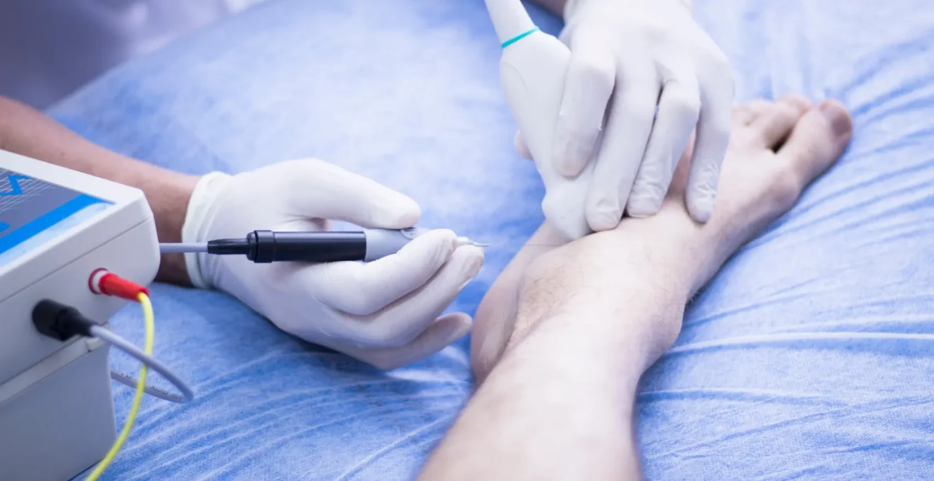 chirurgie percutanée.png