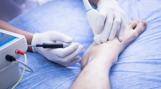 chirurgie percutanée.png